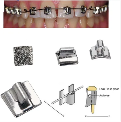 Begg Bracket Bondable Orthodontic Brackets for Anterior/Posterior Teeth - Durable Dental Braces for Precision Alignment