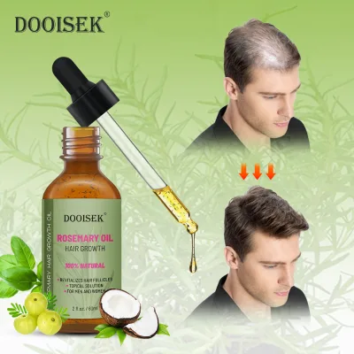 Private Label 100% Natural Hair-Loss Prevention Hair Growth Hair Oil Rosemary Growth Rosemary Lavender Essential Oil