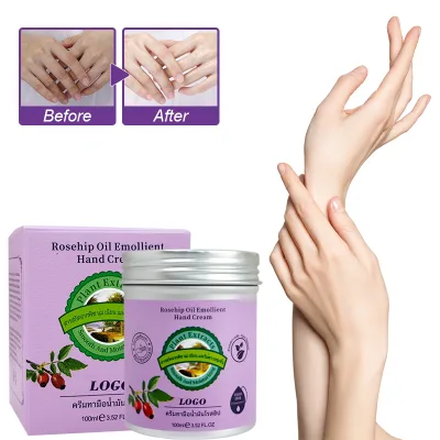 Vegan Hand Exfoliating Moisturizing Whitening RoseHip Seed Oil Children and Adults Hand Cream