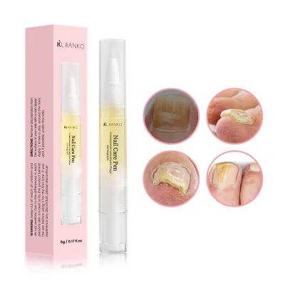 Wholesale Personal Nail Care Products Extra Strength Fungus Treatment Pen for Repair Foot Toe Nail Fungus Toenail Fingernail