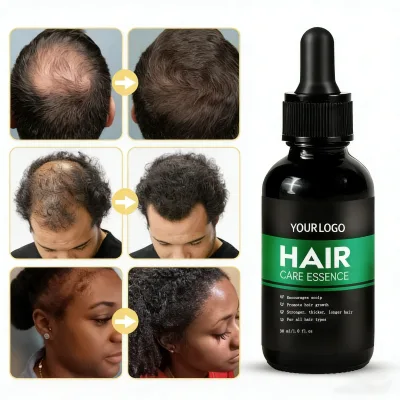 OEM Hair Growth Serum Anti Hair Loss Fast Regrowth Nourishing Scalp Strengthen Hair Root Repair Damaged Hair Care Product