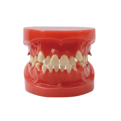 Teaching Model Crowded Teeth Ante-jaw Protrusion Jaw Opening Orthodontic Dental Teeth Model