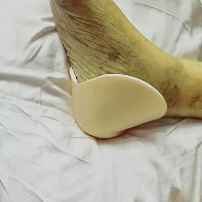 Non-adherent Super Absorbent Foam Pad Elbow Wrist Wound Cover Pad Soft Heel Foam Dressings for Pressure Ulcer Prevention