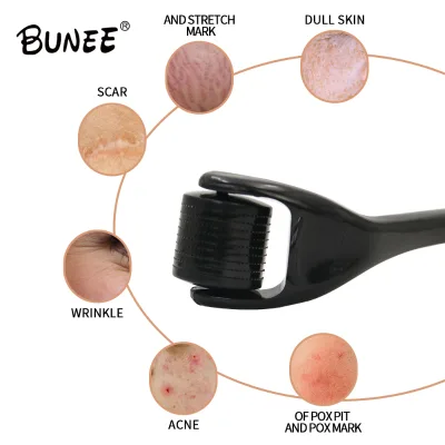 Factory Price Derma Rolleur Skin Regeneration Repair 540 Microneedling Beard Hair Regrowth Derma Roller for Face
