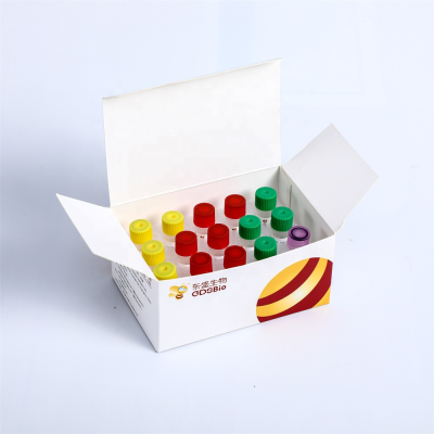 Universal RNA Library Prep Kit for Transcriptome Sequencing