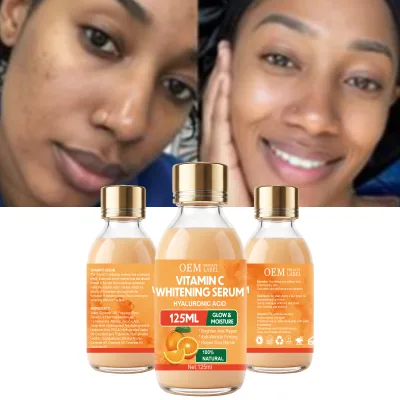 OEM/ODM VC Brightening Serum 125ml Facial Whitening Deep Exfoliating Glowing Skin Antioxidant Face Care