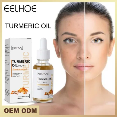 30ml Turmeric Freckle Curcumin Oil Brighten Fade Dark Spot Removal Pigment Melanin Correcting Beauty Face Care Whitening Serum
