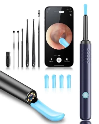 Ear Wax Removal Tool 1080P Camera Silicone Handheld WiFi Ear Cleaning Device Blue