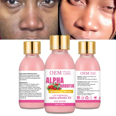2026 New Design Alpha Arbutin Brightening Face Serum 125ml Deep Exfoliation Antioxidant Skincare OEM ODM
