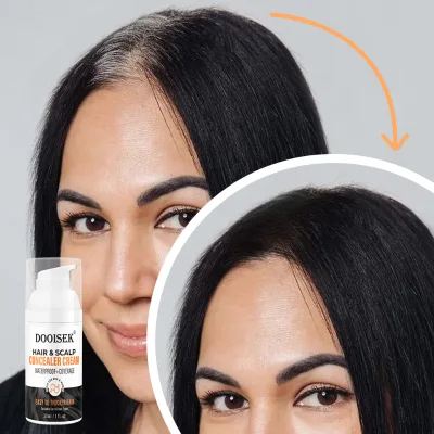 Custom Logo Turkey Waterproof Scalp Filling Concealer Vegan Full Coverage Hair Concealer Liquid 50ml