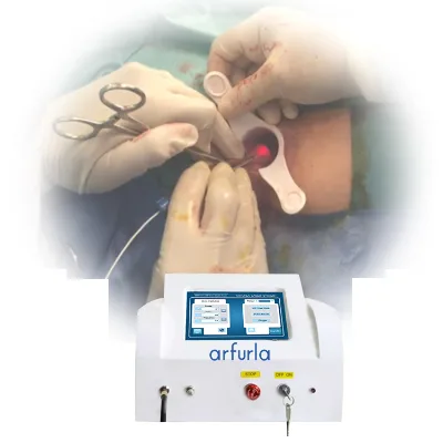 980nm 1470nm Hemorrhoid Diode Laser Machine Treatment Anal Fistula and Hemorrhoids Proctology Device