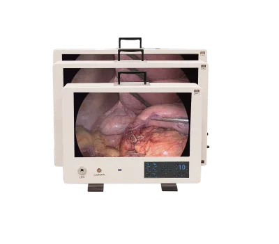 Medical Endoscope System with Large Display 24 Inch Monitor for Diagnostic Accuracy