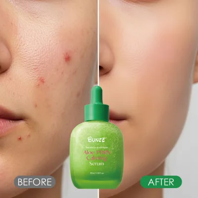 OEM VC Aloe PDRN Liquid Serum for Sensitive Skin Calming & Hydrating Radiant Glow Cica & Aloe Repair Non-Comedogenic