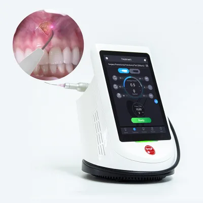 Dental Diode Laser with Three Wavelength 450nm 650nm 980nm for Odontologia Treatment