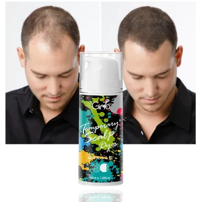 50ML 30ml Liquid Hair Concealer for Scalp Coverage Top-Up Hair Loss Treatment for Body Popular in Barber Shops