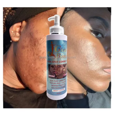 Body Lotion Promotes Smooth Soft Glowing Skin Remove Spots in Autumn and Winter Deeply Restore Skin Tone Unisex Lightening