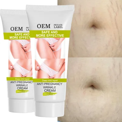 OEM Anti Pregnancy Wrinkle Cream Stretch Marks Reduction and Skin Elasticity Improvement Safe & Effective