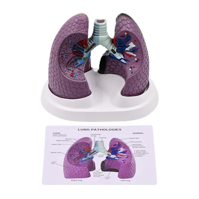 Human lung model smoking-induced lung lesion respiratory department specimen thoracic surgery lung anatomy health education