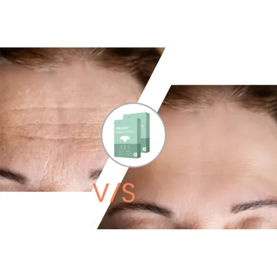 Youthful Forehead Hydrogel Anti-Wrinkle Patches Hydrogel Patches to Remove Forehead Wrinkles Wrinkle-Reducing Hydrogel Patches
