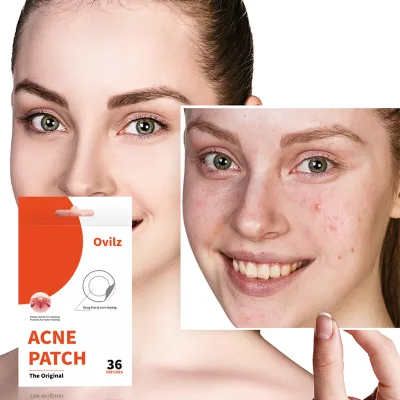 OVILZ Original Korea Hydrocolloid Full Face Patches 36 Dots 0.1mm Microneedle Anti-Acne Pimple Custom Salicylic Tea Tree Oil