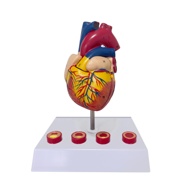 Detachable Life Size Human Heart Anatomical Model With Thrombus