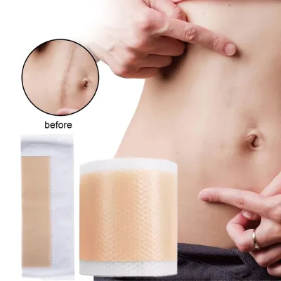 Amazon Hot Selling Scar Revision Silicone Scar Patches 100% Medical-Grade Silicone for Effective Scar