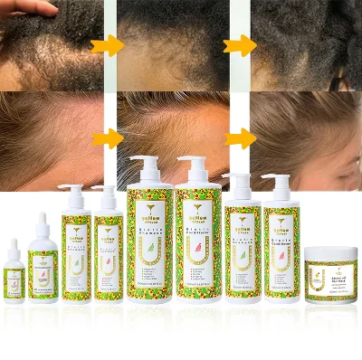 OEM Custom Vitamins Onion Biotin Batana Shampoo and Conditioner Italy Anti Hair Loss Ginger Tea Tree Oil Shampoo to Grow Hair
