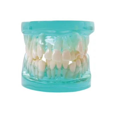 Dental Demonstration Model 28pcs Orthodontic Model Without Brackets