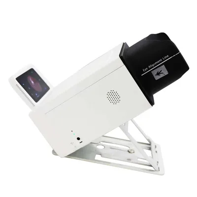 IN-AI Portable Retina Camera Auto Focus System Handheld Fundus Camera for General Eye Clinic