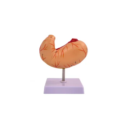 Life Size Detachable Human Stomach Anatomy Model for Doctor-patient Communication