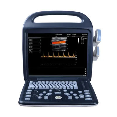 Factory Portable Ultrasound Machine Ultrasound System Color Doppler Ultrasonic Diagnostic Device