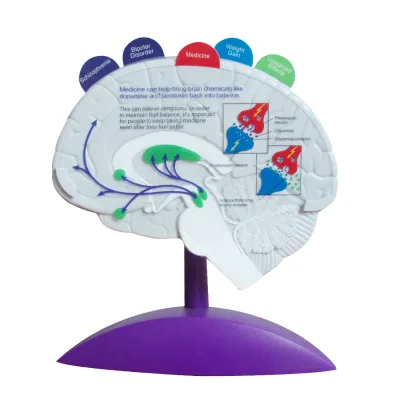 Epilepsy Model Human Brain Pathology Model Anatomical Pharmacy Gift