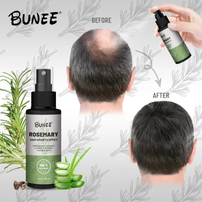 OEM ODM Fast Instant Hair Growth Rosemary Scalp Oil Hair Regrowth Treatment Scalp Care Massage Hair Growth Spray