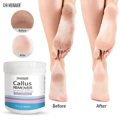 G Organic Moisturizing Foot & Hand Gel Scrub with Aloe Vera for Heel & Callus Removal Natural Exfoliating Formula