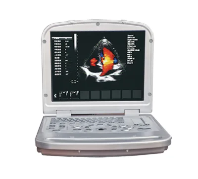 Competitive Price Hospital Equipment 15 Inch LCD Monitor Portable Laptop Color Doppler Ultrasound Machine With Optional Probe