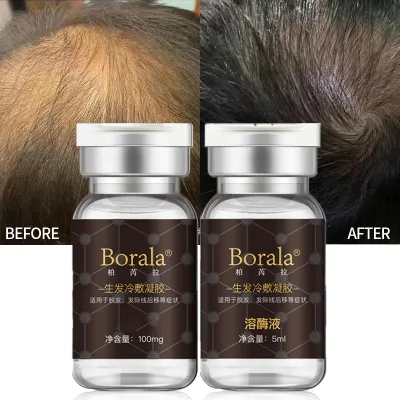 Organic Hair Growth Oil for Men Hair Vitamins Growth Hair Growth Products OEM
