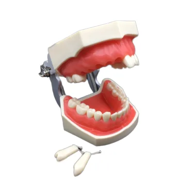 Dental Implant Model, Teeth Model with Pathologies, Removable Dental Model