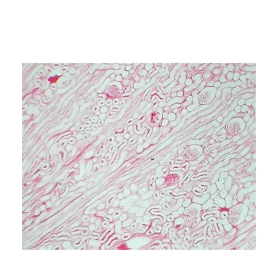 Kidney Injected, Thick Section Physiology Tissue Slides Higher Education Prepared Slides