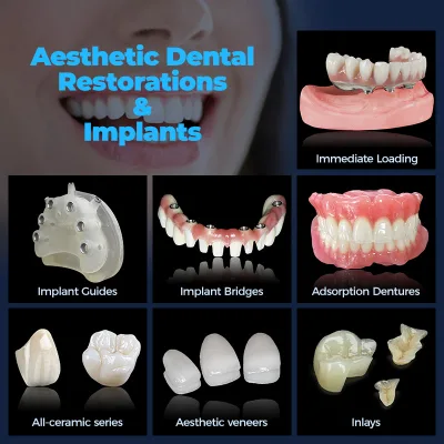 Aesthetic Dental Restorations and Implants Veneers Teeth Veneer Dental Smile Dental Veneers