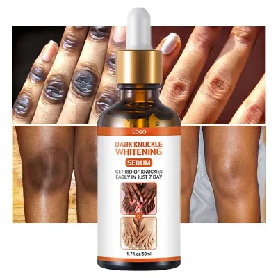 Custom Black Skin Remover Dark Elbows Hand Legs Knees Strong Effective Dark Knuckle Whitening Serum