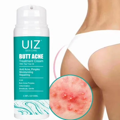 Calming Hypoallergenic Body Butt Acne Lotion Body Thigh Removal Pimples Treatment Repair Skin Hip Anti Acne Cream