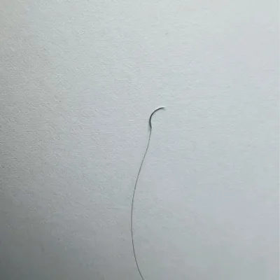 High Tensile Strength Nylon Suture Medical Ophthalmic Surgical Suture Sterile Eye Suture for Ophthalmology Department