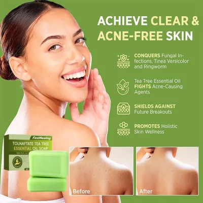 Organic Solid Handmade Soap Bar with Tea Tree Oil for Acne and Pimple Healing