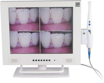 Intra Oral Camera Dental Equipment Dental Oral Camera