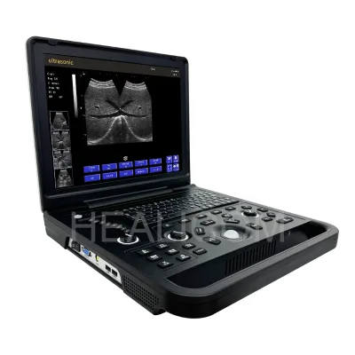 Hot Sale 15 Inch LCD Screen Multiple Languages One Click Report Generation Page Portable Medical Ultrasound Machine