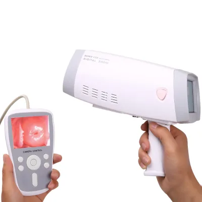 Cheap Price Portable Handheld Digital Video Colposcope Electronic Colposcope for Gynecology