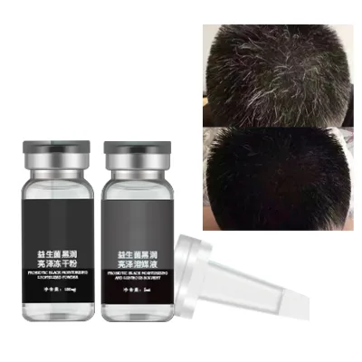 Ginger Improves Hair Growth Strengthens Hair & Balances Scalp Moisturizes Skin & Nourishes Ginger Oil