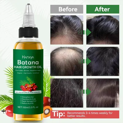 Best Seller Batana Oil Promotes Hair Growth Repair for Men and Women Enhances Hair and Skin Radiance Honduras Batana Oil