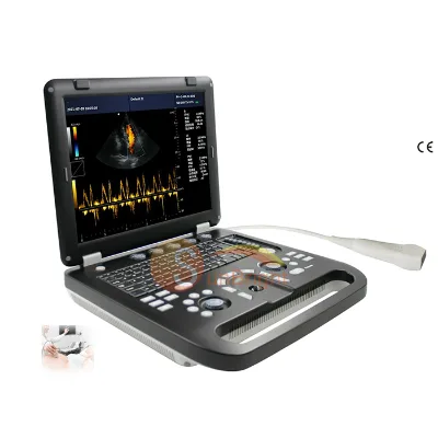 Clinic Dedicated Laptop Color Doppler with 15 Inch Screen for Clear 3D 4D and Color Flow Imaging