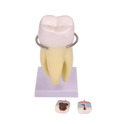 The enlarged 3x model of the molar teeth for standard teaching purposes can be disassembled into 6 pieces